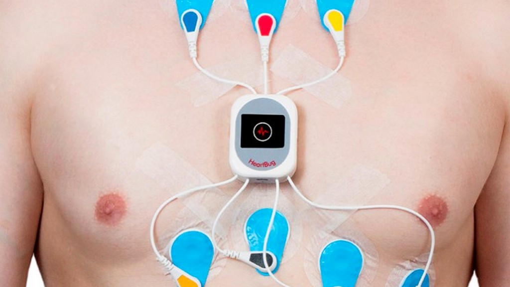 24 Saatlik Holter Kayıt Cihazları