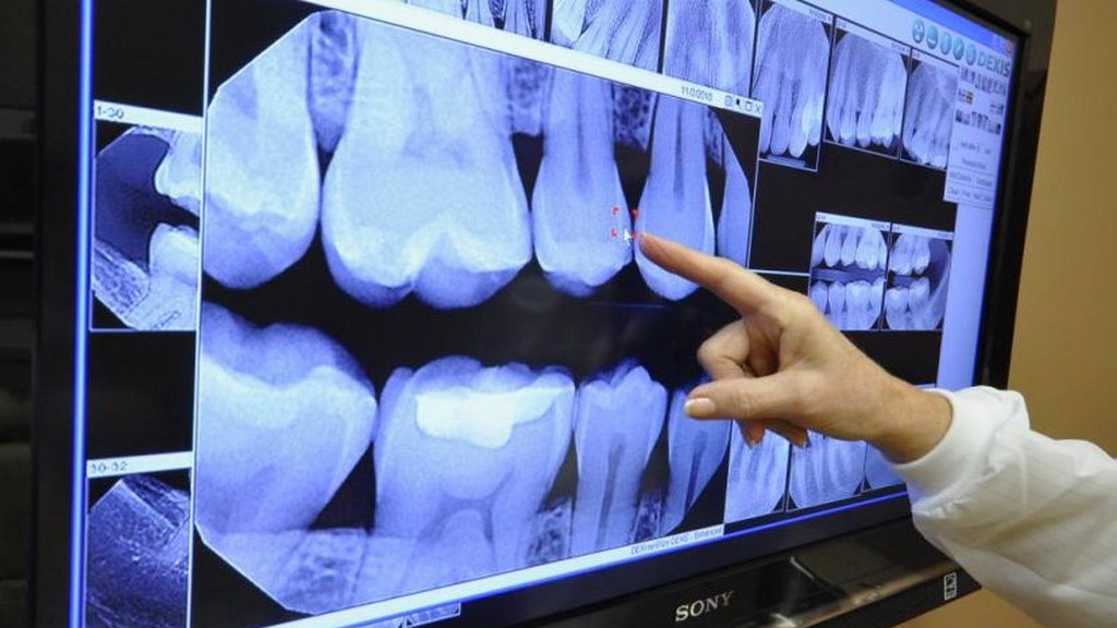 3D Röntgen Mikroskopları