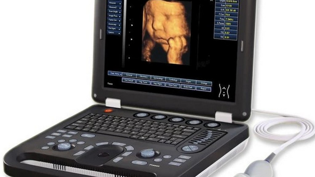 3D/4D Obstetrik Ultrason Cihazları