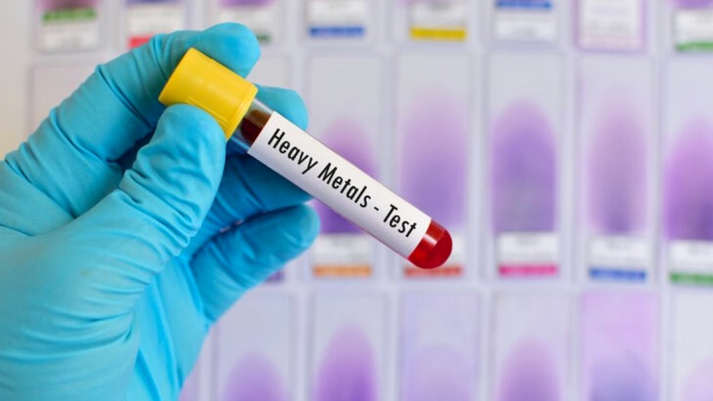 Ağır Metal Zehirlenmesi Test Kitleri