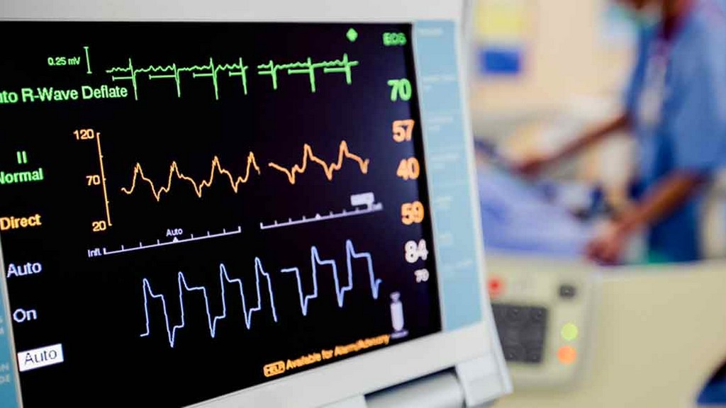EKG Makineleri