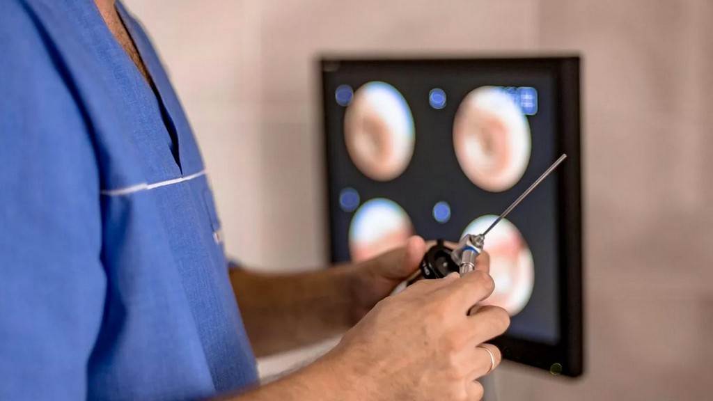 Endoskopik Kamera Sistemleri