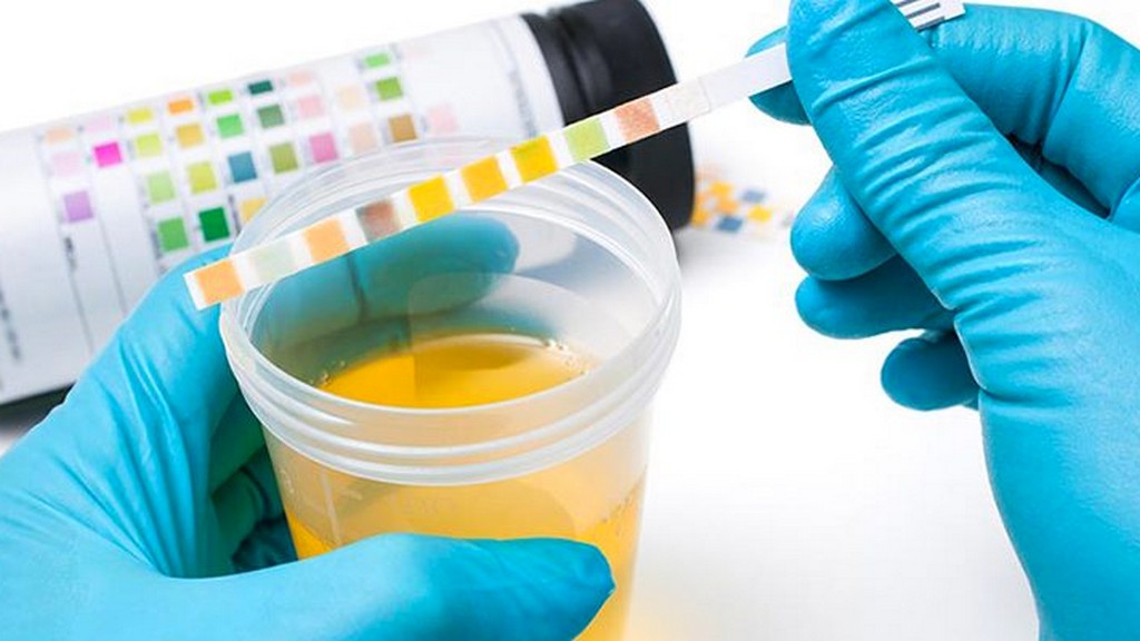 Genetik ve Metabolik Test Kitleri:
