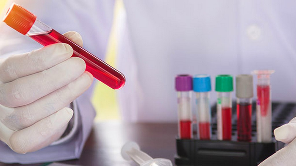 İmmünolojik Test Kitleri