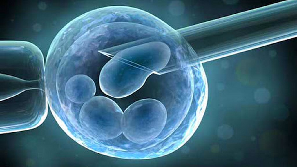 İn Vitro Fertilizasyon (IVF) İnkübatörleri