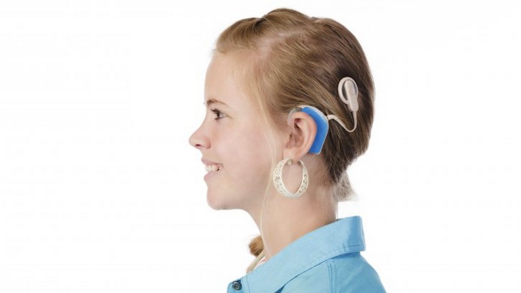 İşitme İmplantları