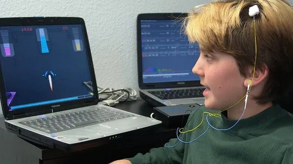 Nörofeedback Cihazları