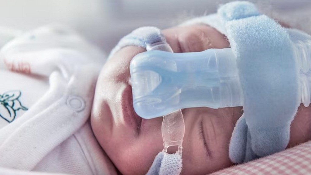 Pediatrik Solunum Destek Cihazları