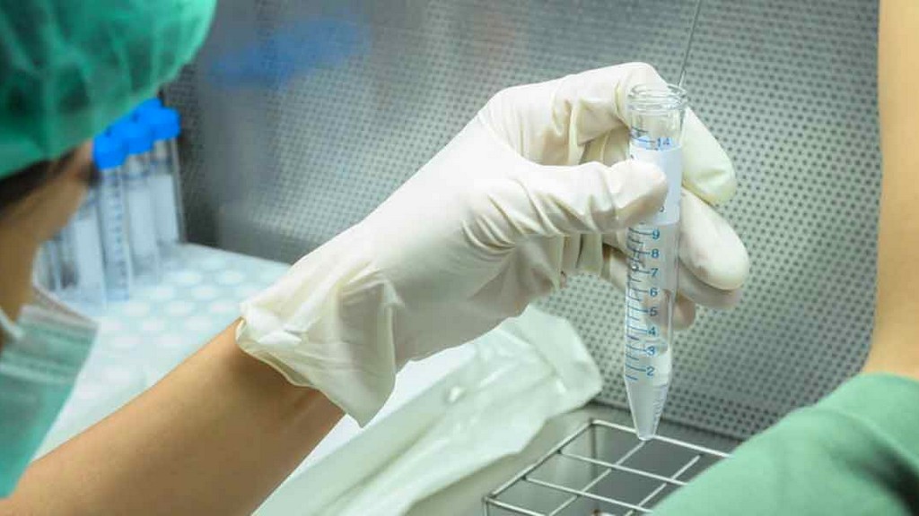 Sperm Analiz Cihazları