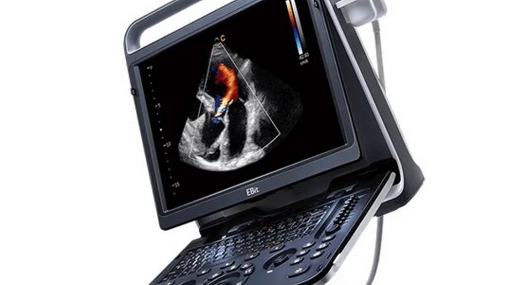 Ultrason ve Elastografi Ekipmanları