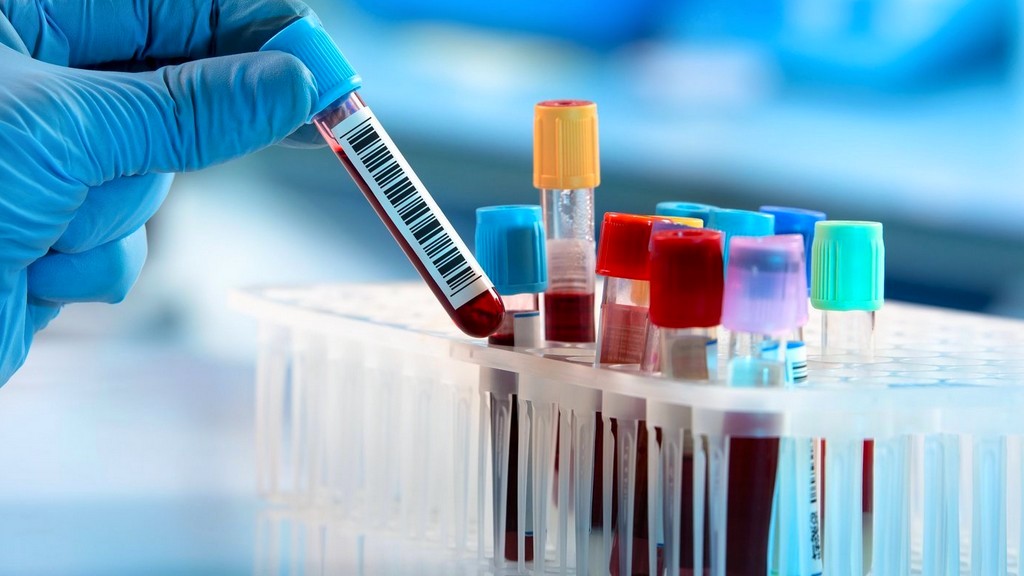 Hematoloji Cihazları