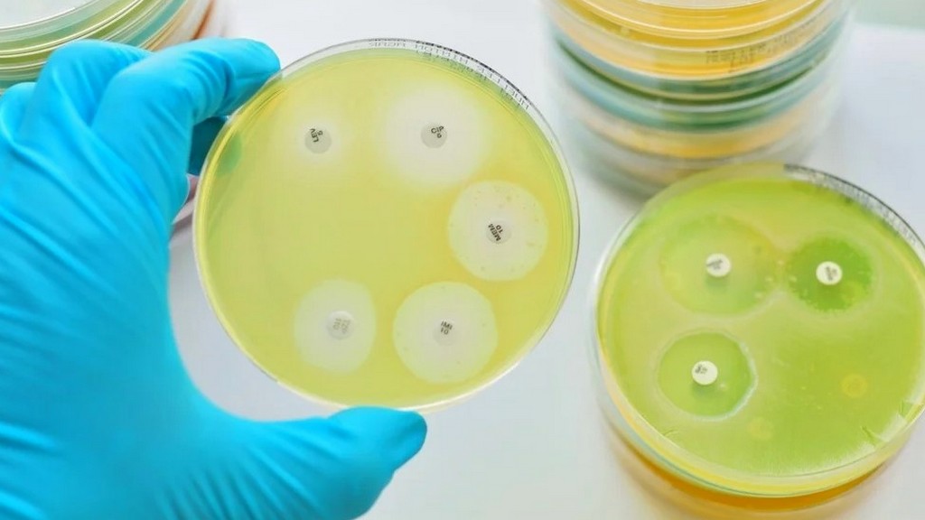 Antimikrobiyal Duyarlılık Testi