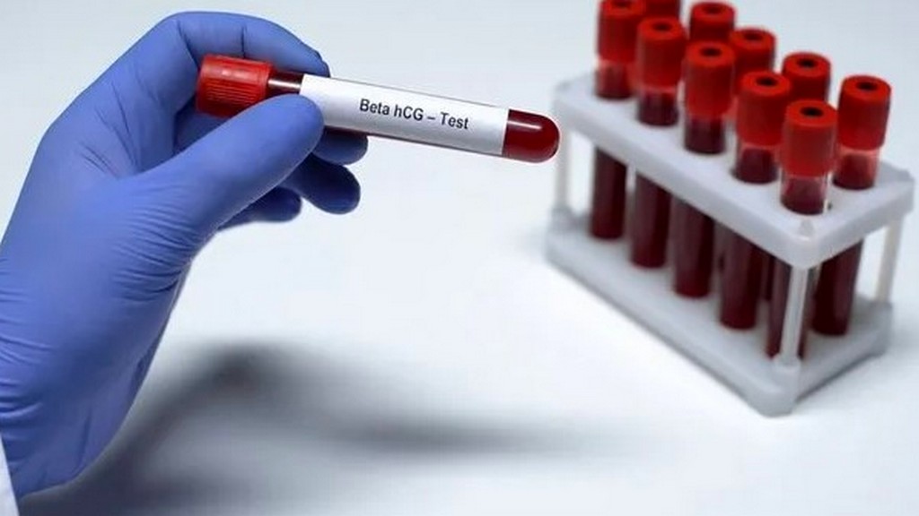 Beta-hCG Test Kitleri