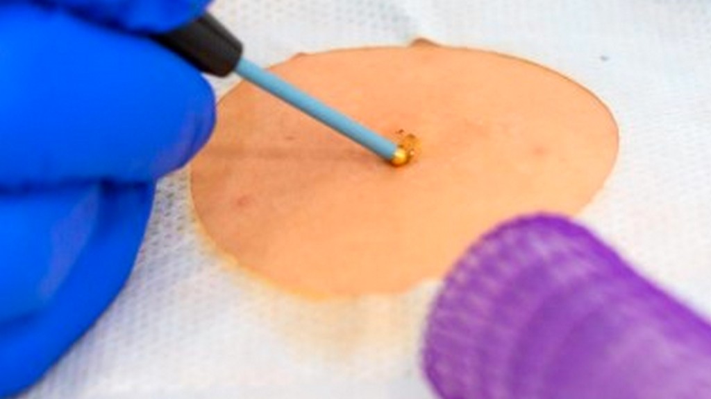 Biopsi Kesme ve Yerleştirme Cihazları