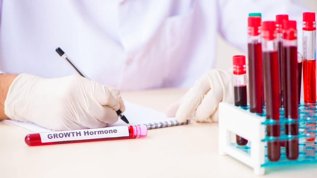 Büyüme Hormonu Test Kitleri