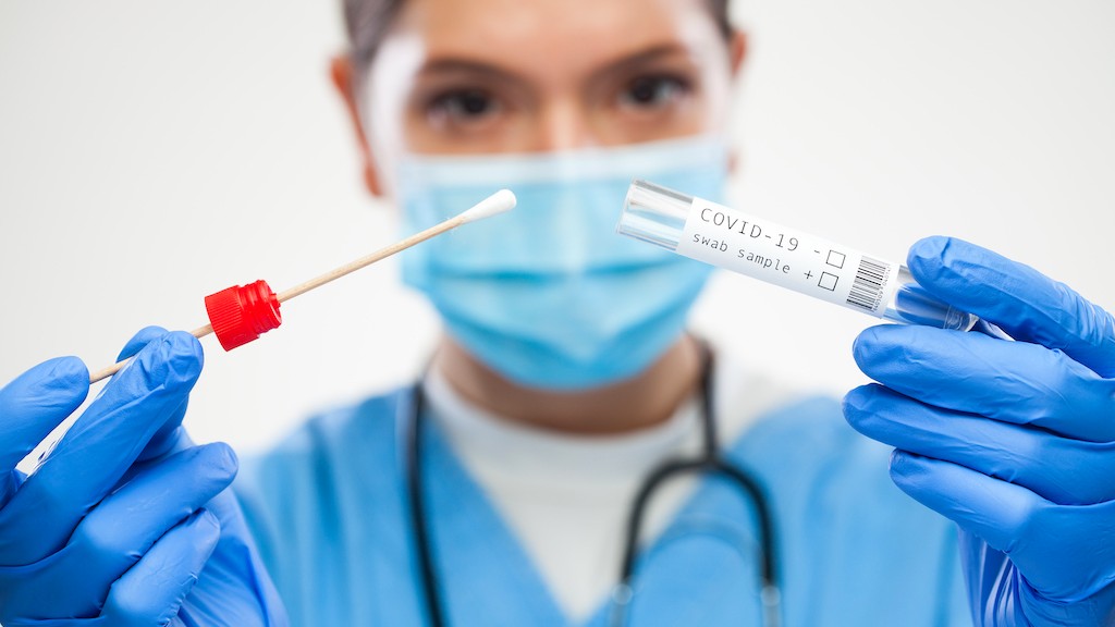 COVID-19 - SARS-CoV-2 Testi
