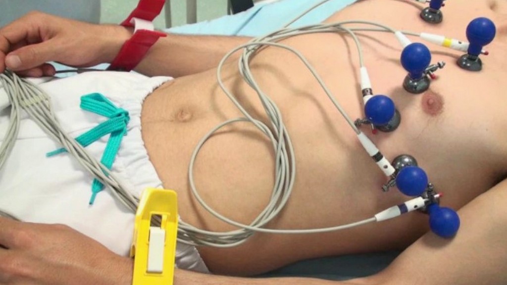 Eforlu EKG Cihazı Kalibrasyonu