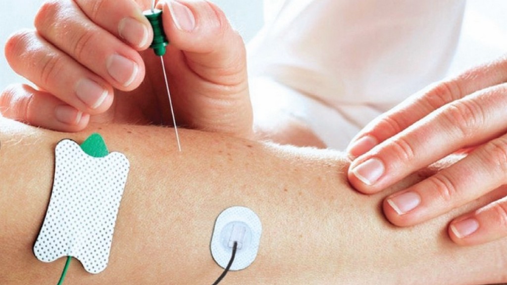 Elektromiyografi (EMG) Sistemleri