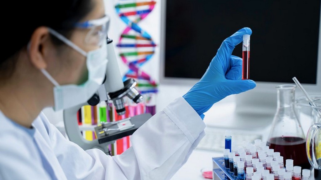 Hematoloji Testleri
