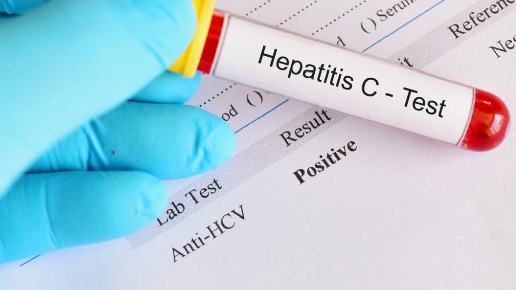 Hepatit C Virüsü (HCV) Testi