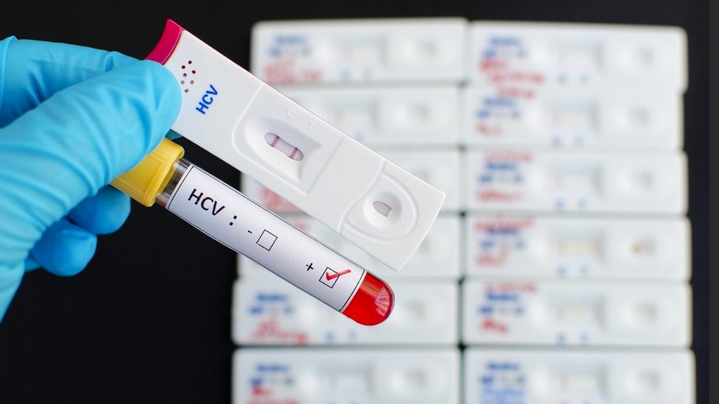 Hepatit Test Kitleri
