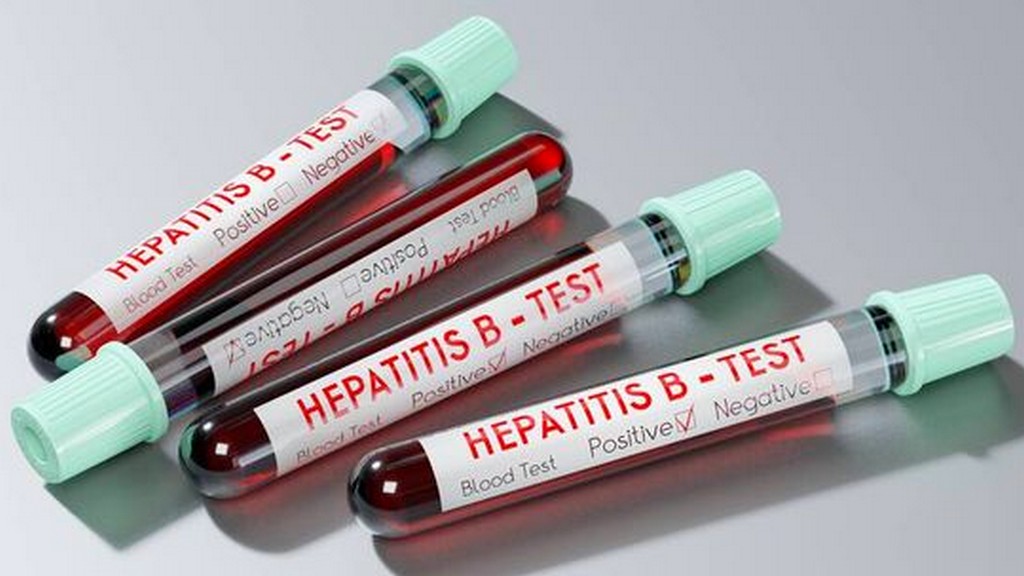 Hepatit Testleri