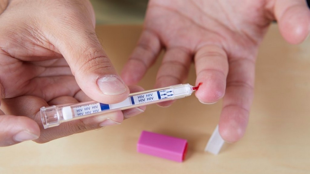 HIV Test Kitleri