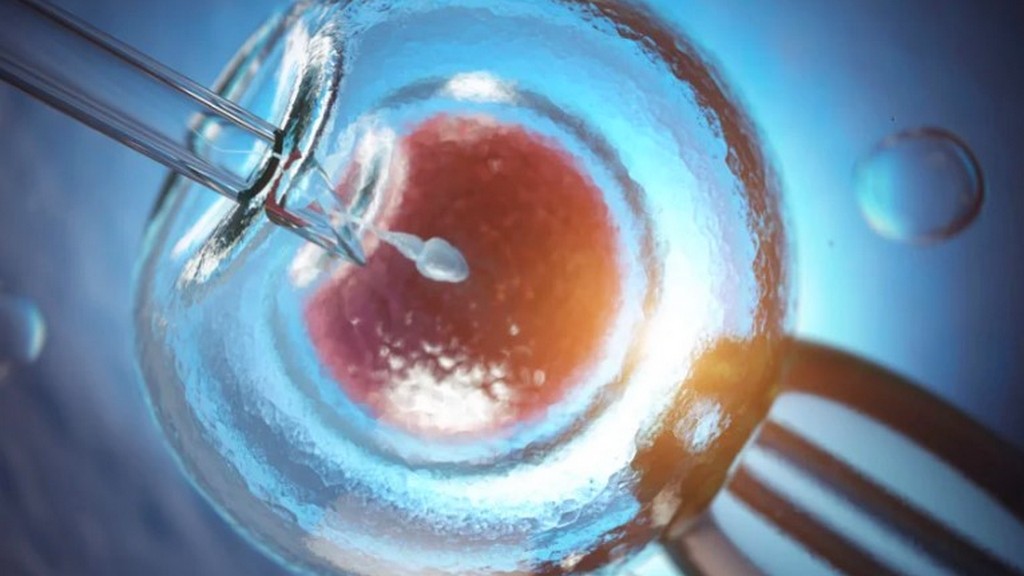 ICSI (İntrasitoplazmik Sperm Enjeksiyonu) Mikromanipülatörleri
