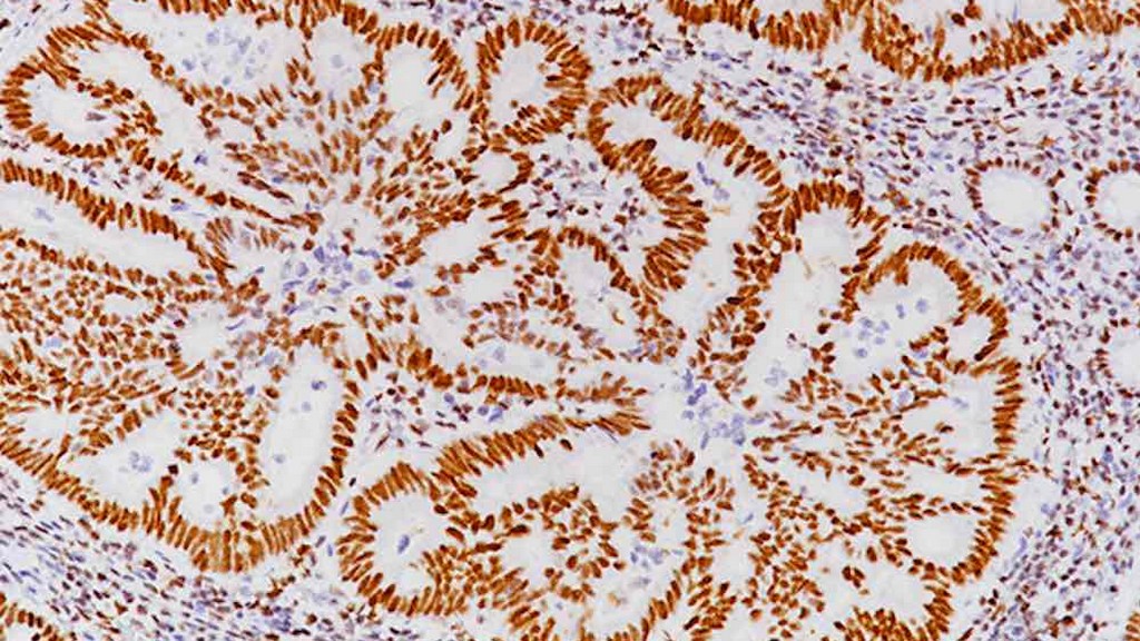 İmmunohistokimya Boyama Sistemleri