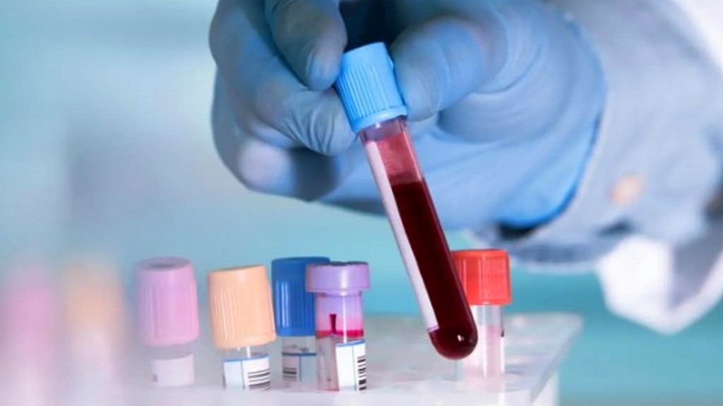 Karaciğer Fonksiyon Test Kitleri
