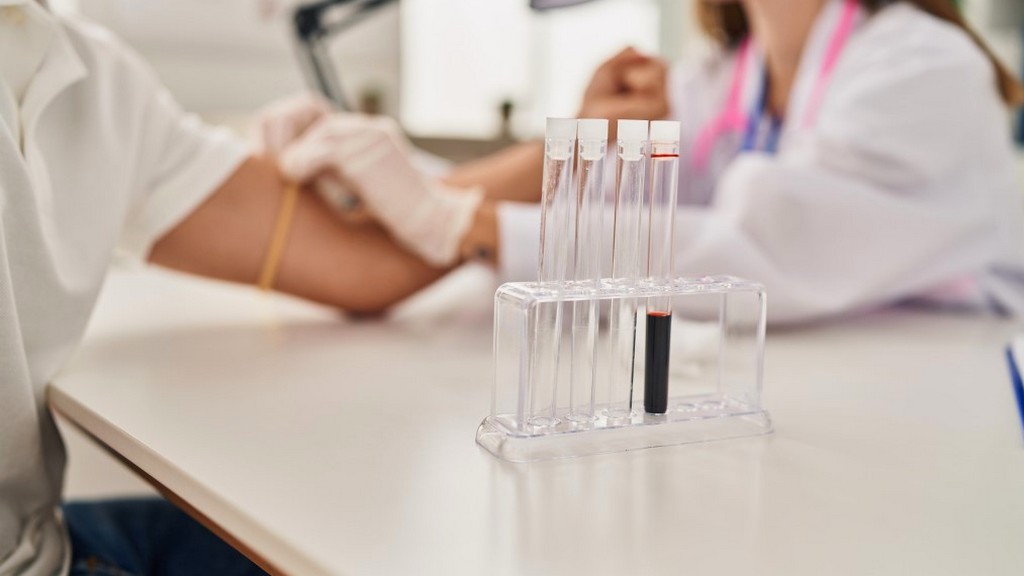 Klinik Kimya Testleri