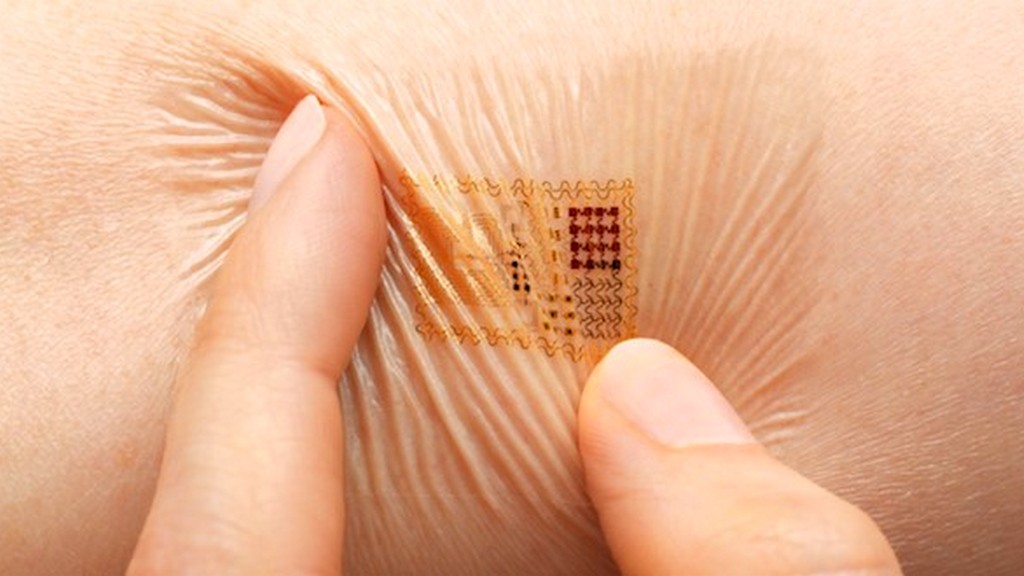 Nanoteknoloji Tabanlı Biyosensörler