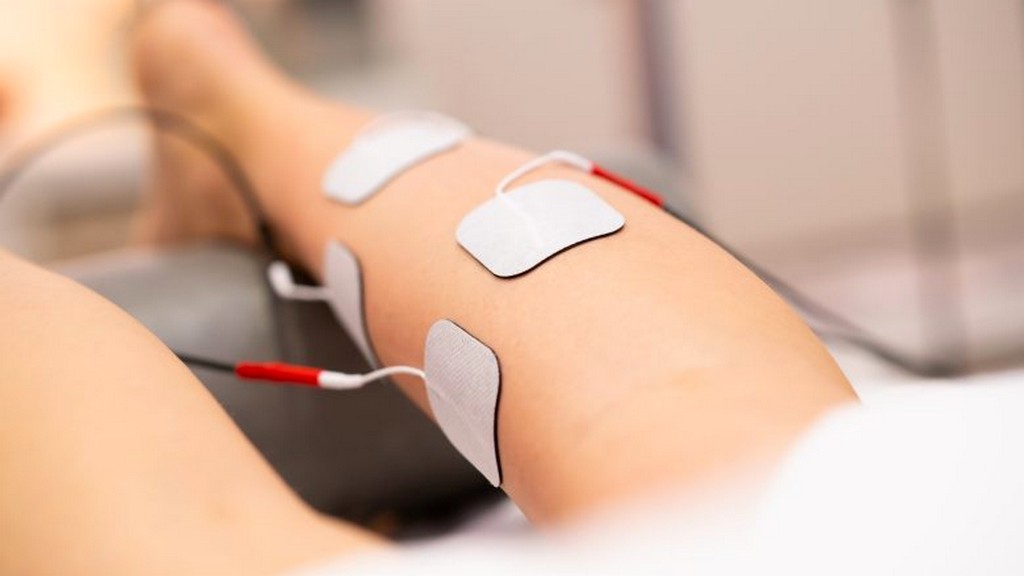 Nöromusküler Elektriksel Stimülasyon (NMES) Cihazları