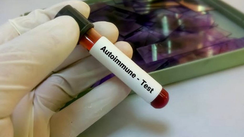 Otoimmün Hastalık Test Kitleri