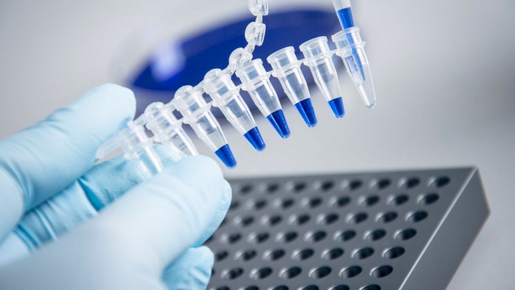 PCR Optimizasyon Kitleri