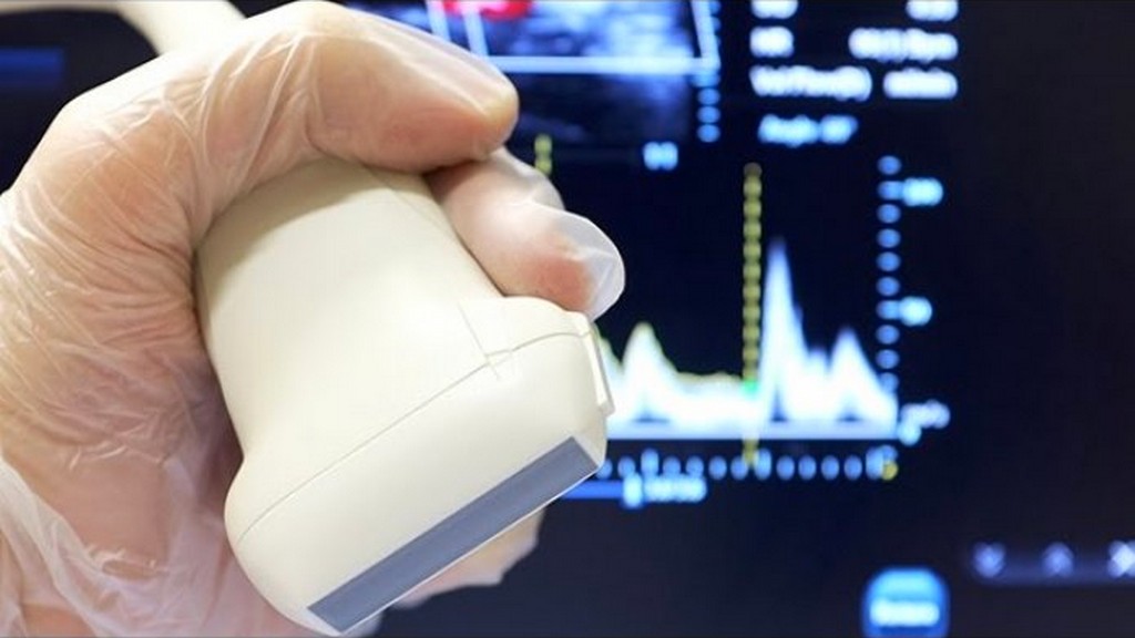 Penil Doppler Ultrason Cihazları