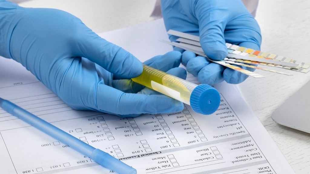 Plazma Protein Testleri