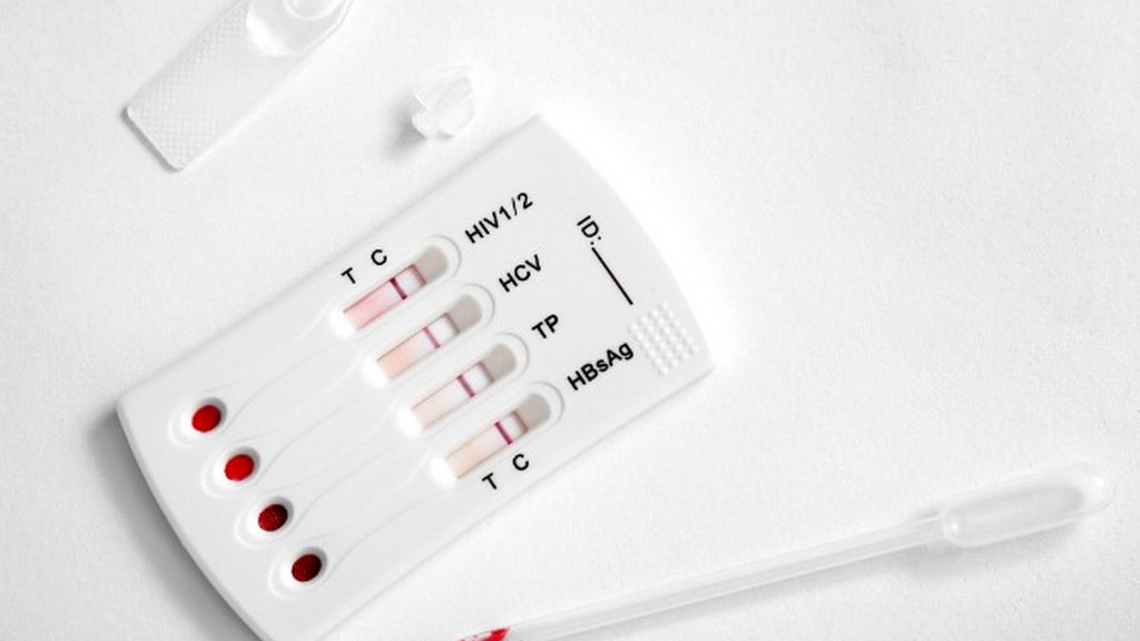 Seksüel Yolla Bulaşan Hastalıklar için Test Kitleri