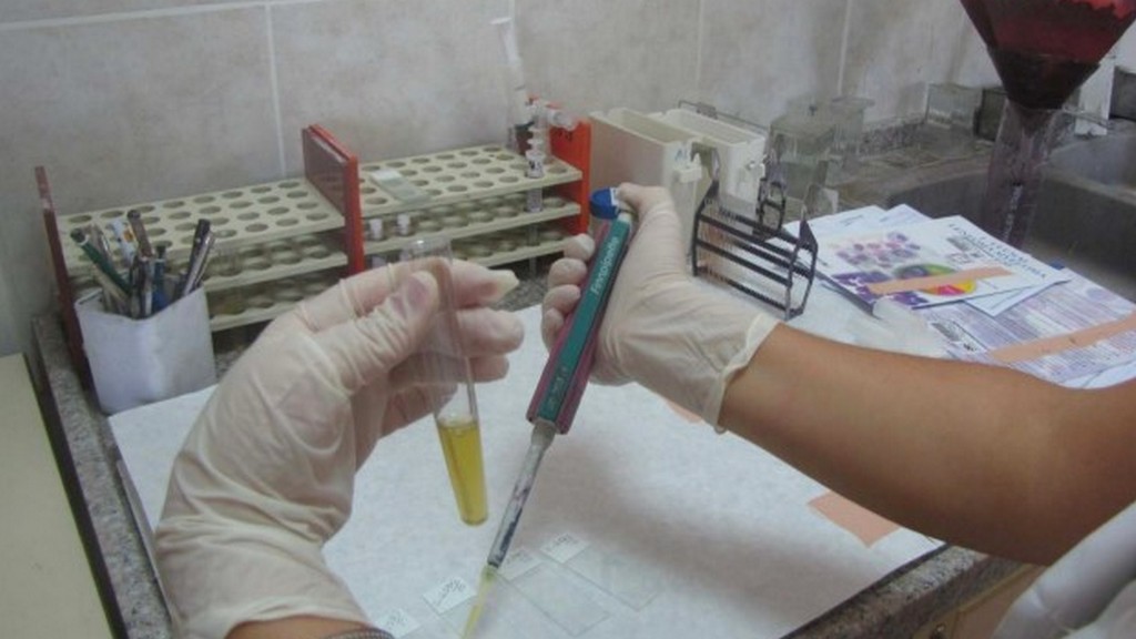 Sitolojik Numune Hazırlama Aksesuarları