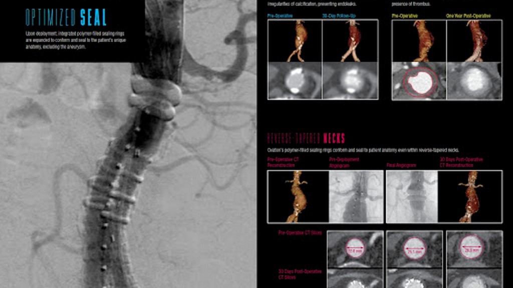 Stent Görüntüleme Sistemleri