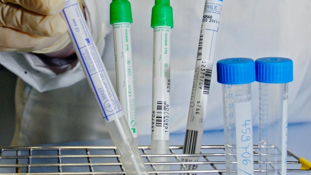 Stres Hormonları Test Kitleri