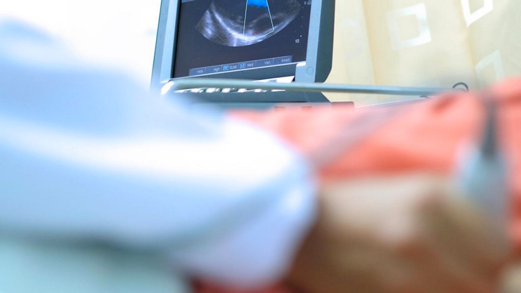 Transözofageal Ekokardiografi (TEE) Cihazları