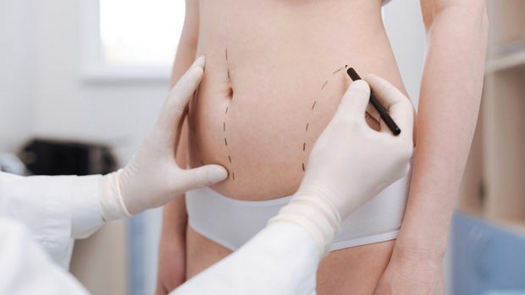 Ultrasonik Liposuction Sistemleri