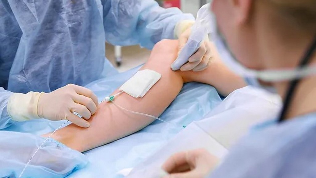 Varis Skleroterapi Cihazları