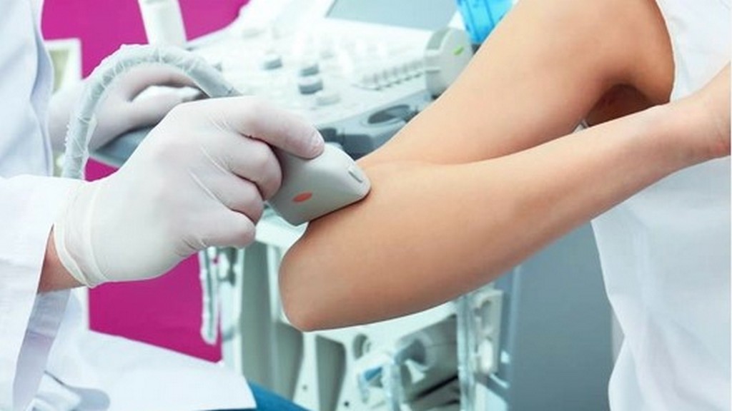 Vasküler Ultrasonografi Cihazları